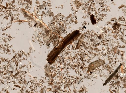 Balantidium coli