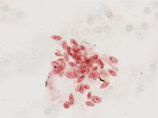 Paramecium calkinsi