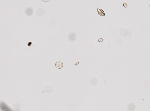 Cestoda