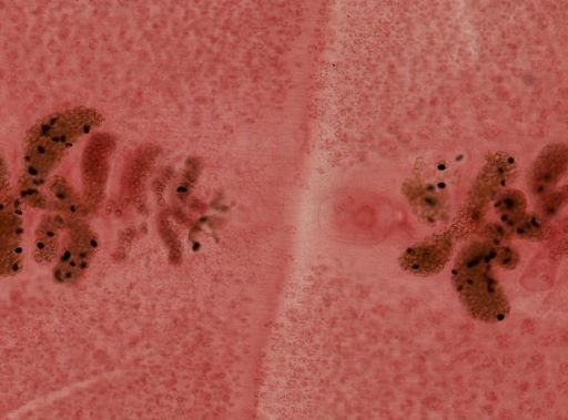 Diphyllobothrium latum