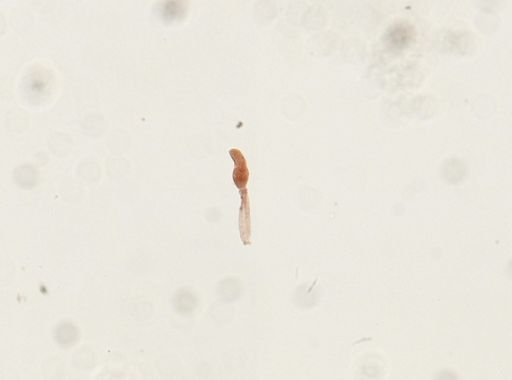 Schistosoma mansoni