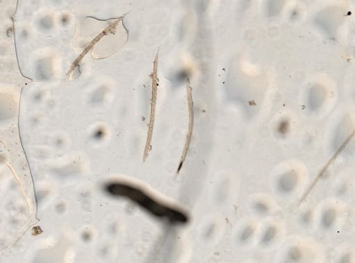 Ancylostoma