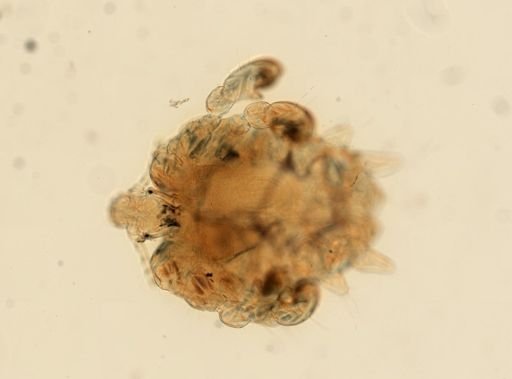Pthirus pubis