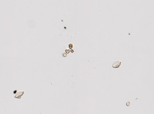 Cestoda