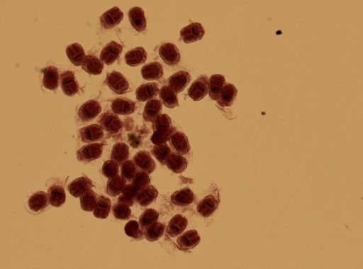 Echinococcus granulosus