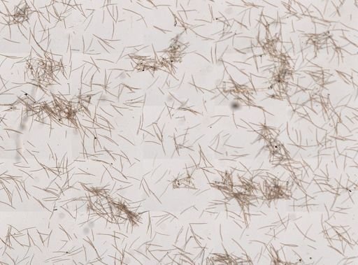 Haliclona (Haliclona)?