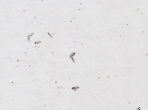 Paramecium caudatum