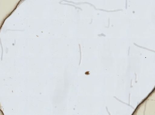 Lecane pycina