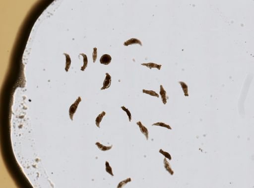 Bdelloidea