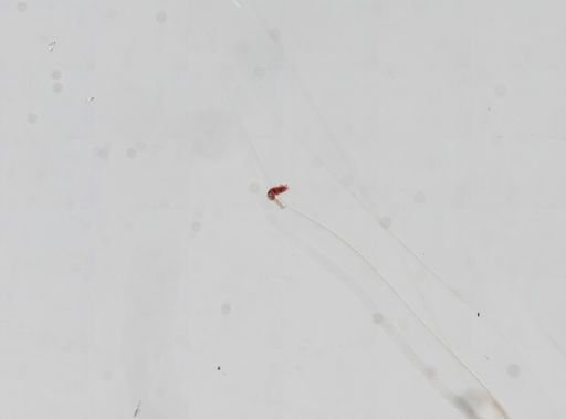 Trematoda