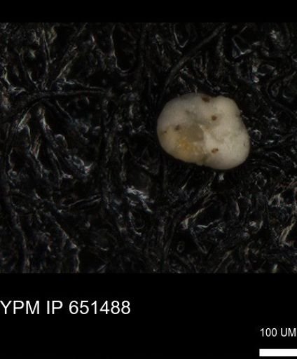 undet. Foraminiferida