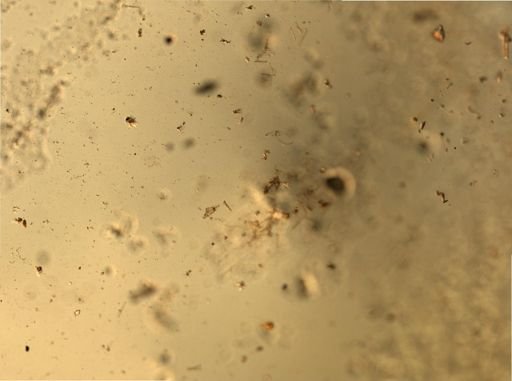 Bacillariophyceae