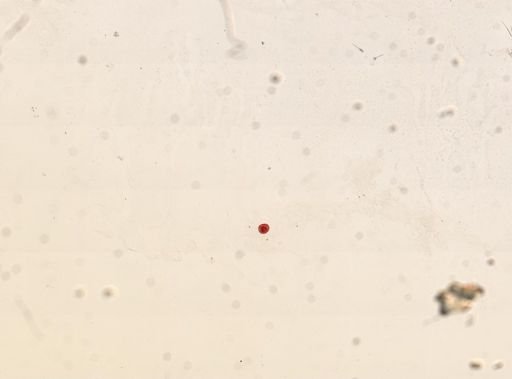 Didinium nasutum