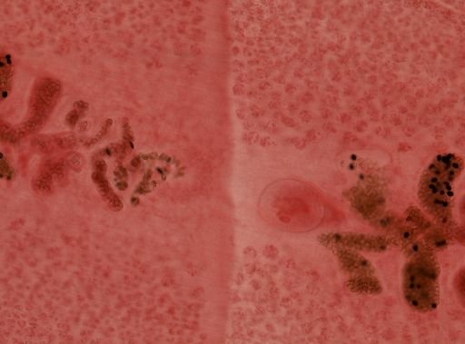 Diphyllobothrium latum