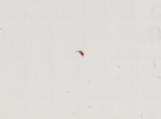 Trematoda