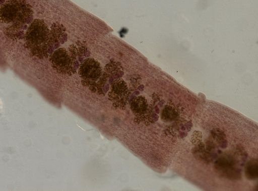 Eucestoda
