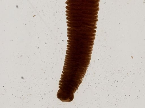Raillietina cesticillus