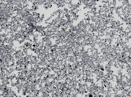 Giardia lamblia