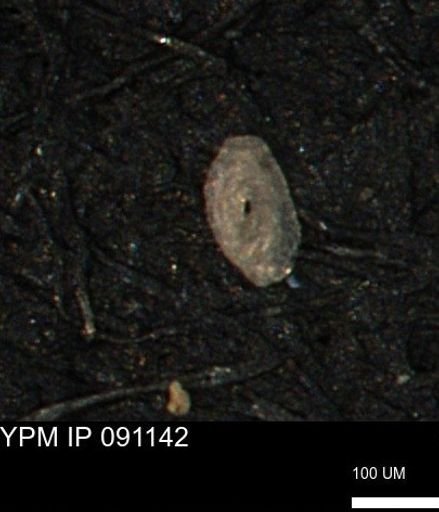 Miliammina cf. sproulei