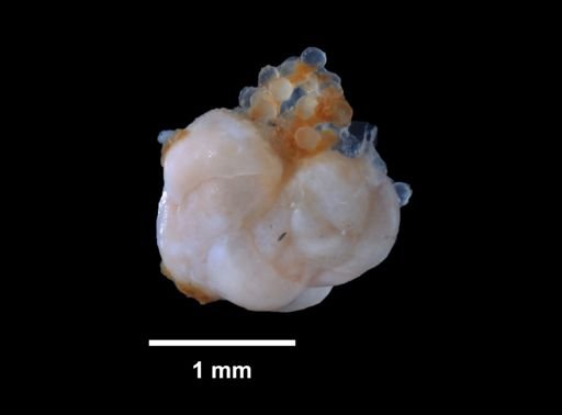 Foraminifera