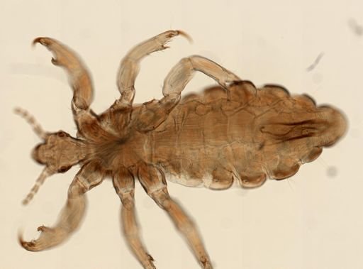 Pediculus humanus
