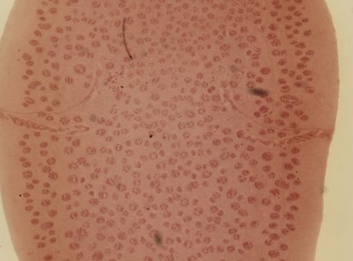 Dipylidium caninum