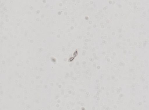 Blepharisma undulans