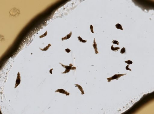 Bdelloidea