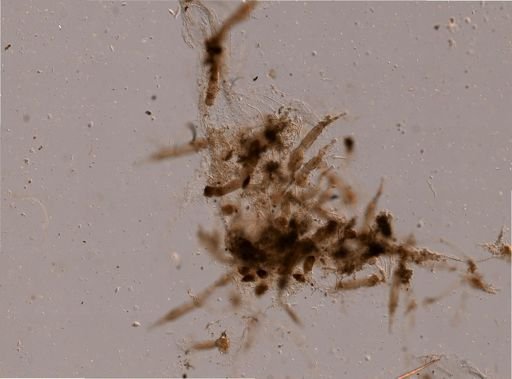 Bryozoa