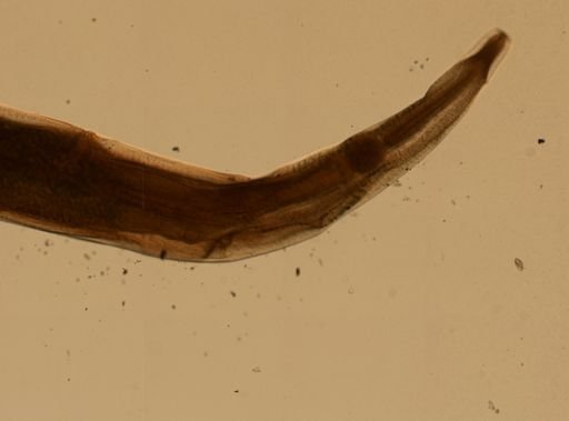Enterobius vermicularis