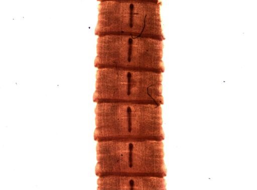 Diphyllobothrium erinacei