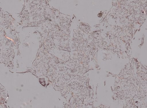 Amphimedon erina