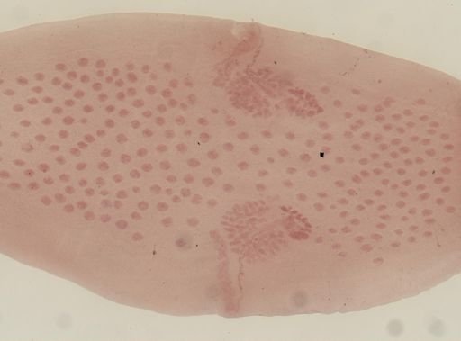 Dipylidium caninum