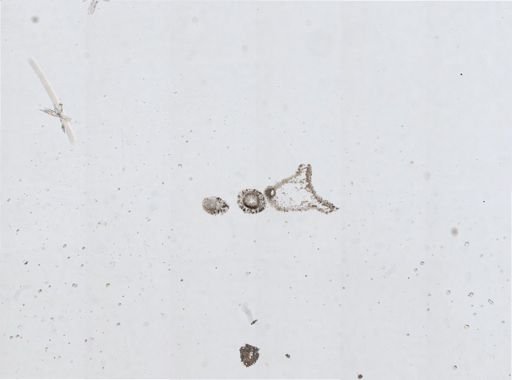 Dendronotus frondosus