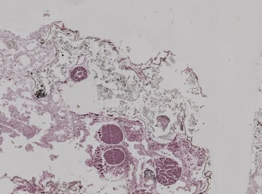 Leucosolenia