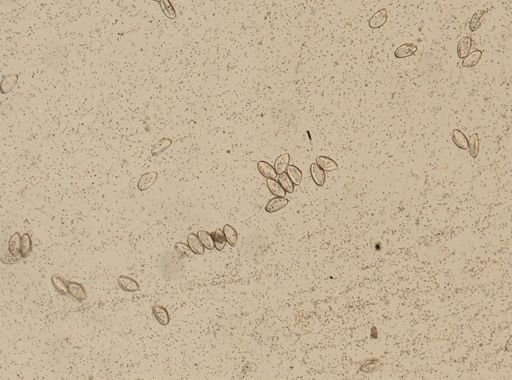 Enterobius vermicularis