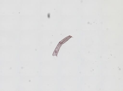 Hyalella cf. azteca