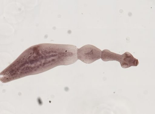 Echinococcus granulosus
