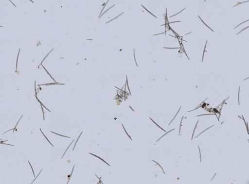 Spongilla fragilis