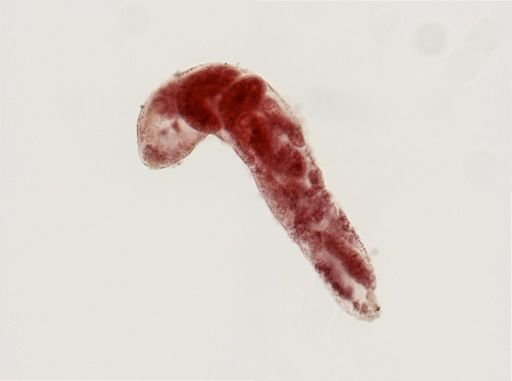 Trematoda