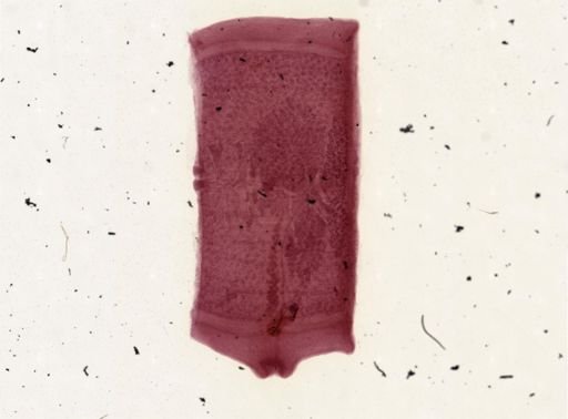 Taenia solium