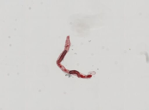 Trematoda
