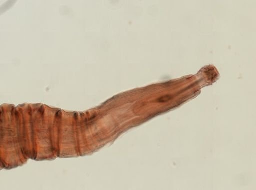 Oligacanthorhynchus microcephalus