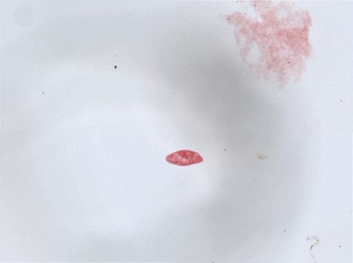 Paramecium aurelia