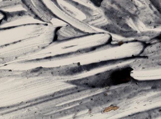 Entamoeba histolytica