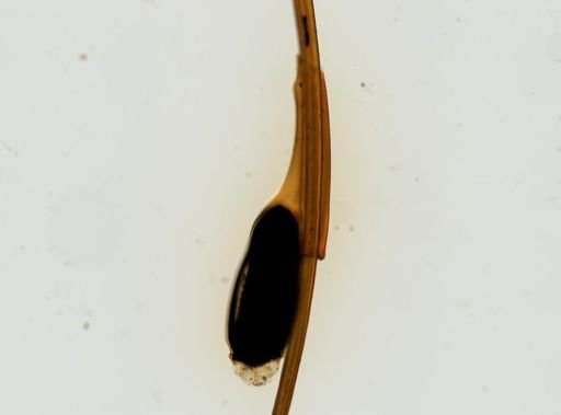 Pthirus pubis