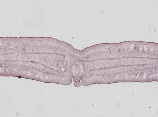 Diphyllobothrium latum