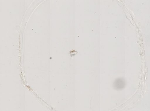Paramecium