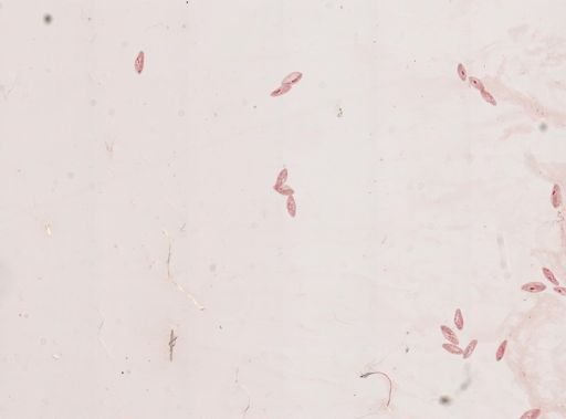 Paramecium