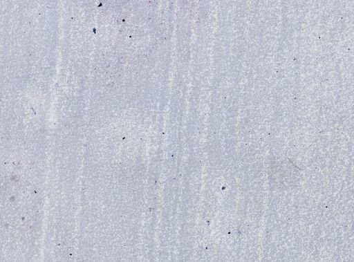 Trypanosoma equiperdum